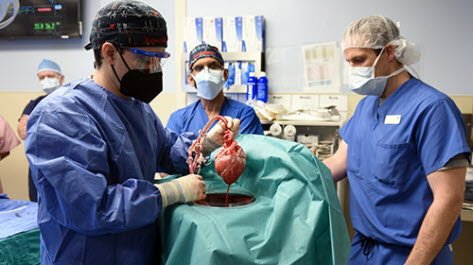Pour la première fois, des chirurgiens américains ont greffé le cœur d’un porc sur un humain avec succès